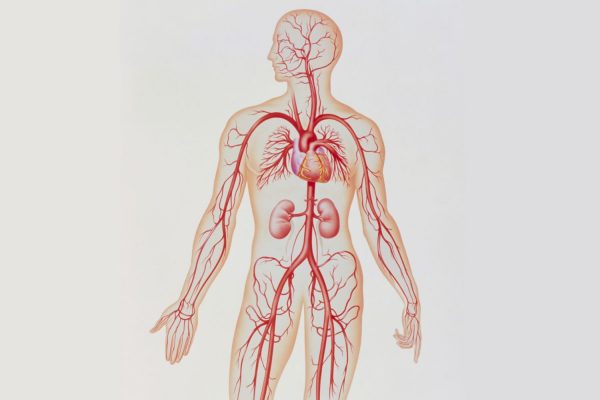 Blocked Arteries: Causes and Symptoms